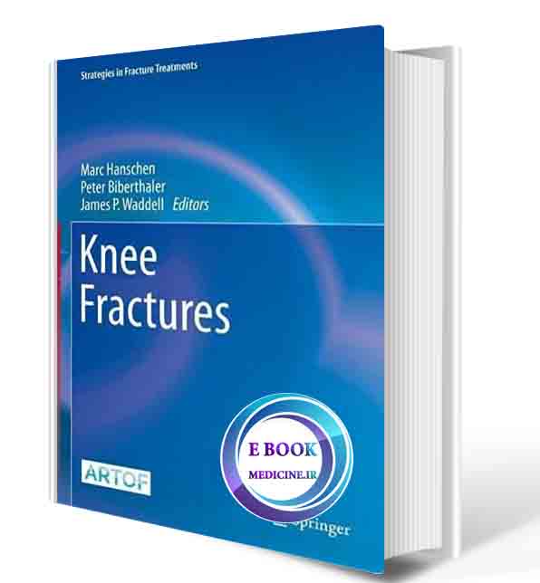 دانلود کتاب Knee Fractures (Strategies in Fracture Treatments) 1st ed. 20211 (ORIGINAL PDF)